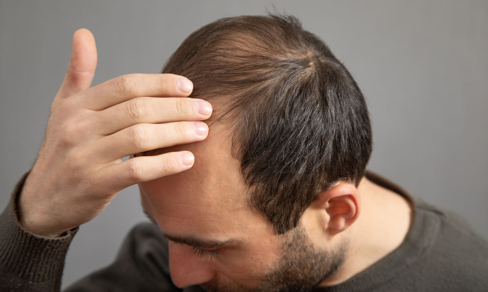 Nikita Hair Hårtap hos menn mann