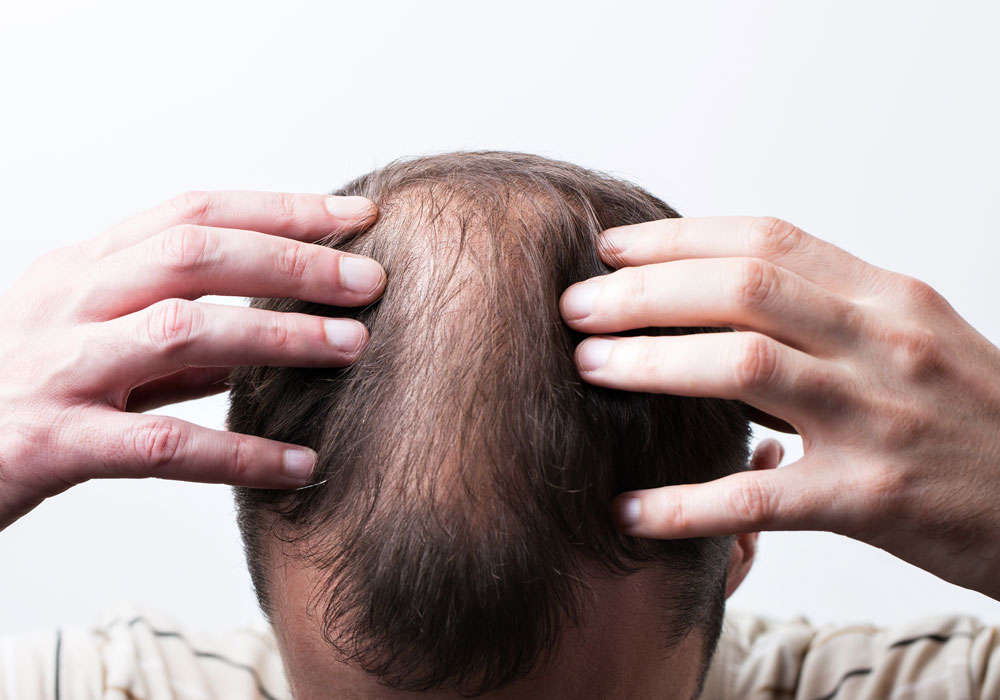 Nikita Hair Hårtap hos menn mann