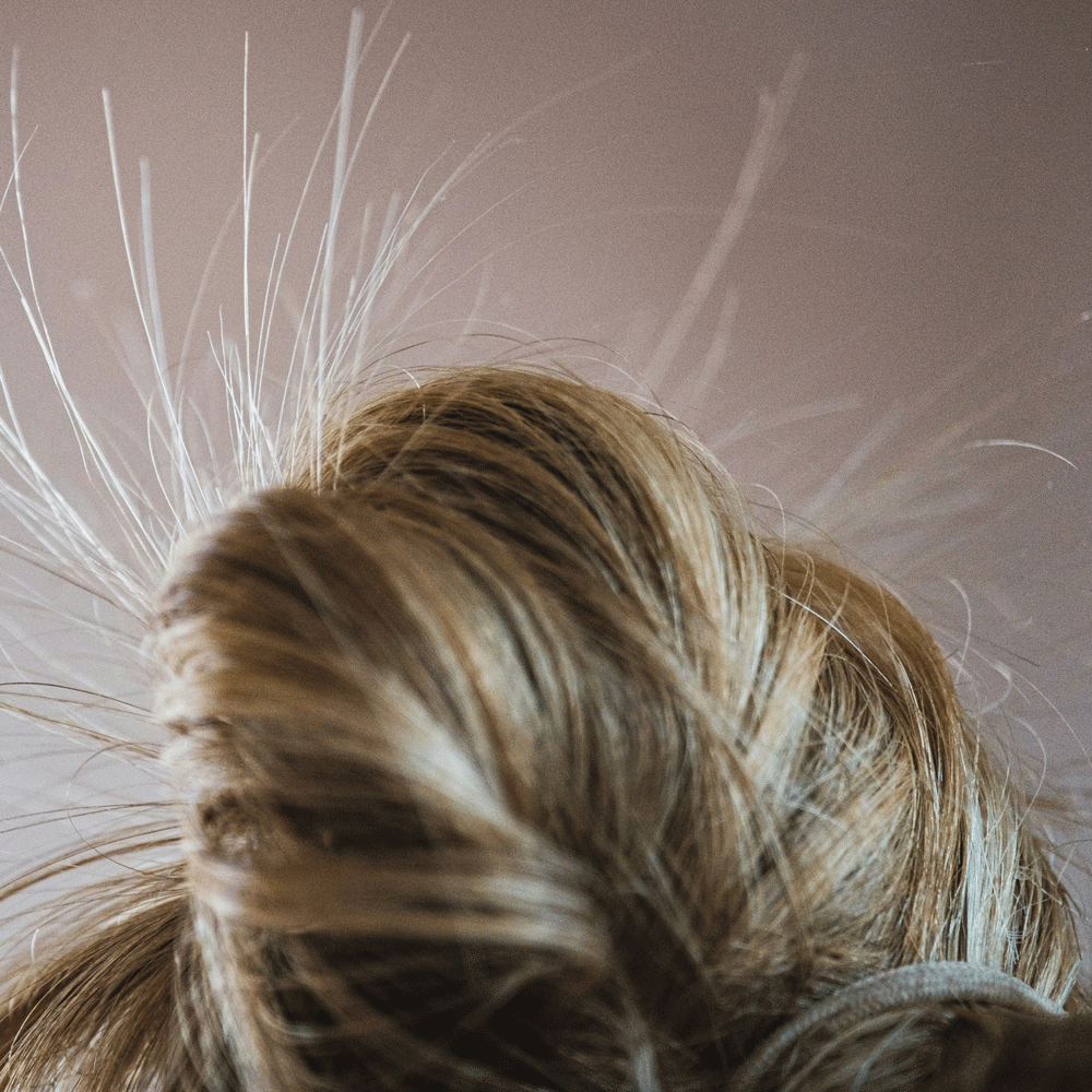 Statisk hår med små elektriske hårstrå som står rett ut på grunn av tørr luft.